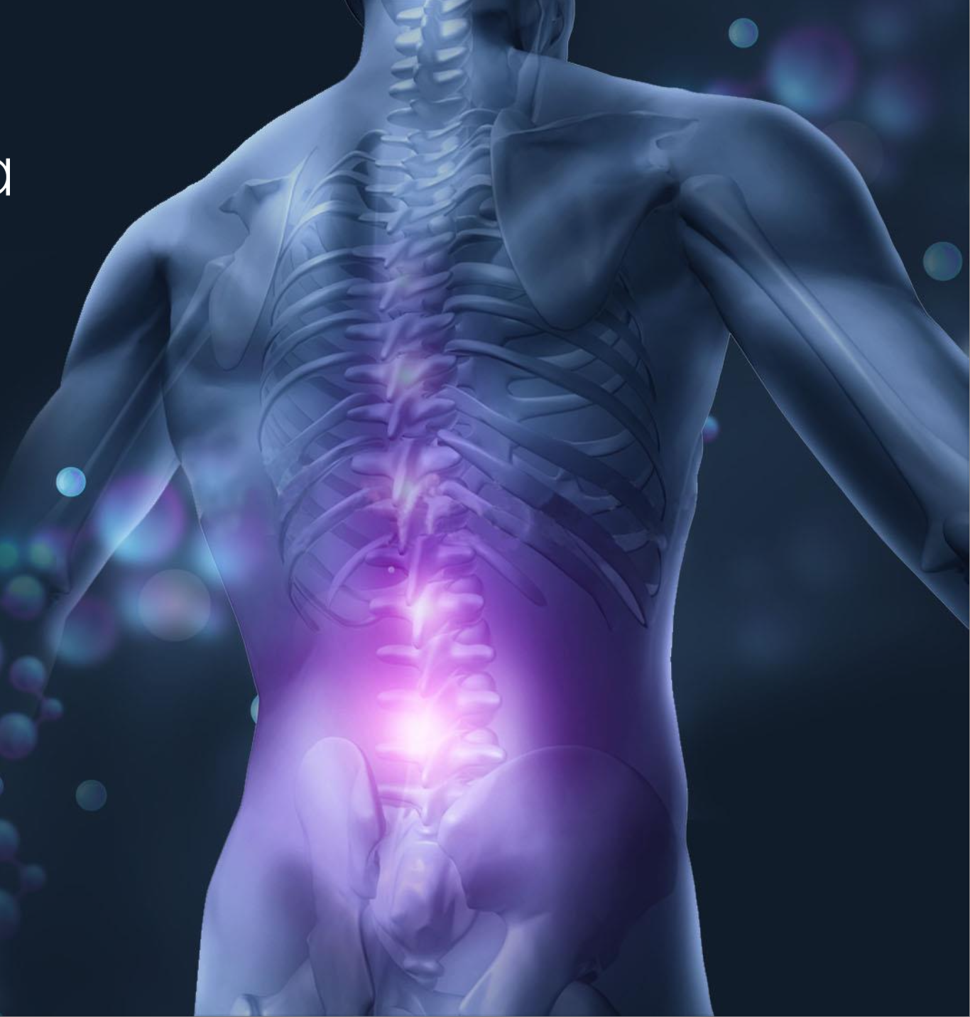 Spine BioPharma, Inc. Announces Completion of Enrollment for Phase 3 Clinical Trial of SB-01 to Address Chronic Low Back Pain